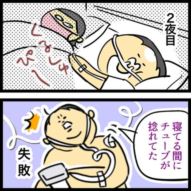 睡眠時無呼吸症候群の夫／へそ