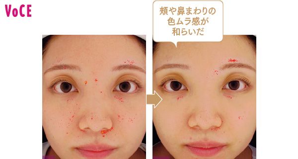頰や鼻まわりの色ムラ感が和らいだ