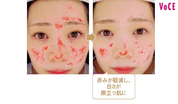 赤みが軽減し、白さが際立つ肌に