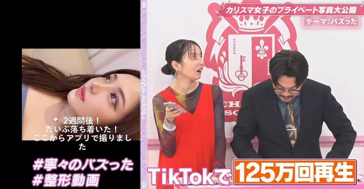 【写真・画像】整形後の経過を詳細に投稿した画像が大バズリのキャバ嬢、オズワルド伊藤「時代が全然違いますね」 2枚目