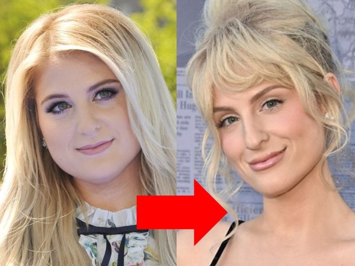 激やせセレブたちの＜ビフォー＆アフター＞をチェック！ （C）AFLO width=