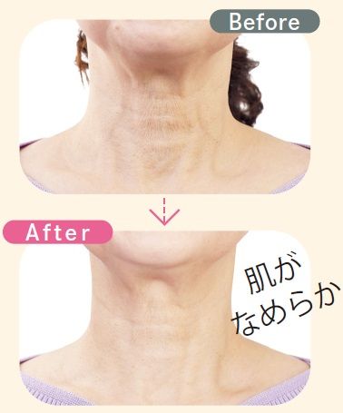 大山志津子（おおやま・しずこ）さん（当時63歳）