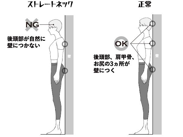 【NG】ストレートネック／後頭部が自然に壁につかない、【OK】正常／後頭部、肩甲骨、お尻の3ヵ所が壁につく