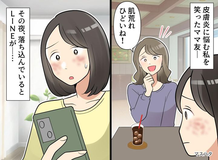 画像: 皮膚炎に苦しむ私に、ママ友が「顔ひどいね（笑）」なんて残酷な言葉、、え！？ 夜に『まさかの連絡』が