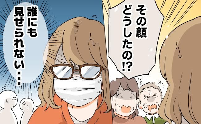 肌のトラブルに悩む女性