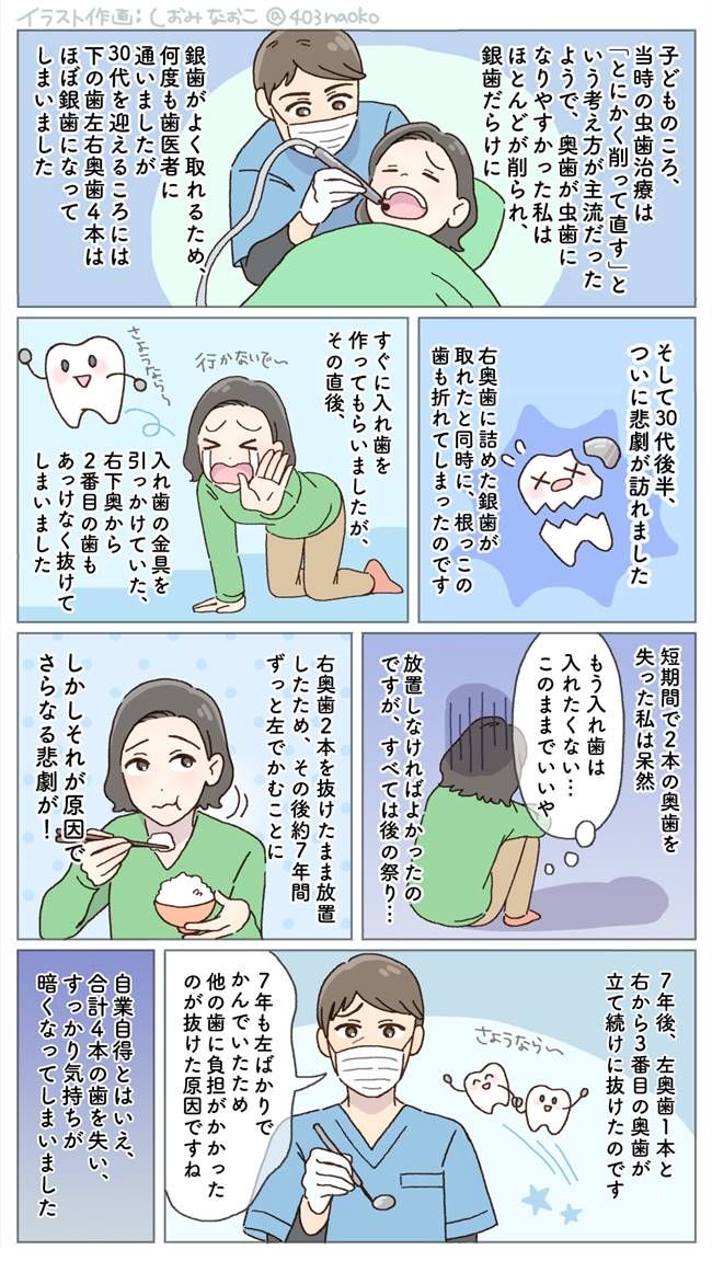 4本の歯を失い、200万円かけて治療した女性