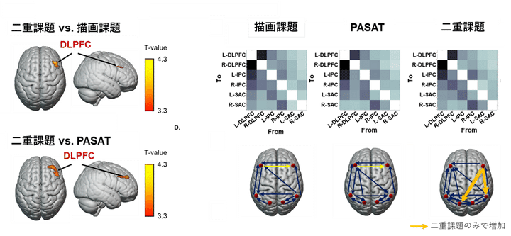 左：マルチタスクで活動が増加した脳領域、右：情報伝達もマルチタスクでのみ増加