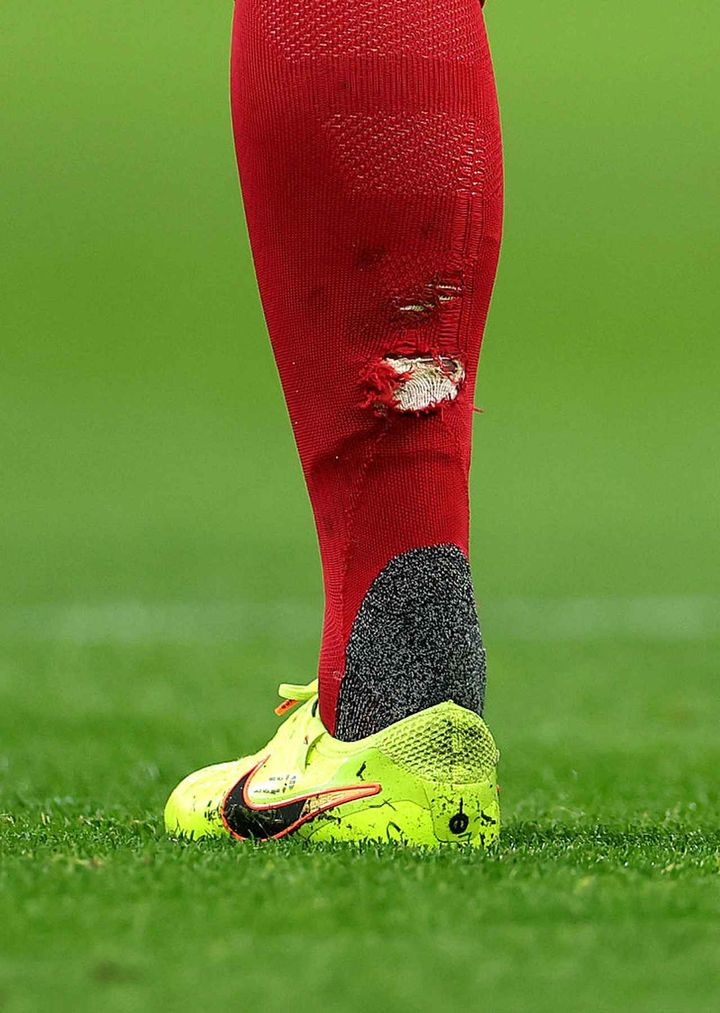 画像2: (C)Getty Images