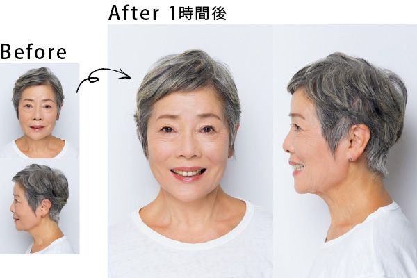 笑顔に自信が持てるようになりました！