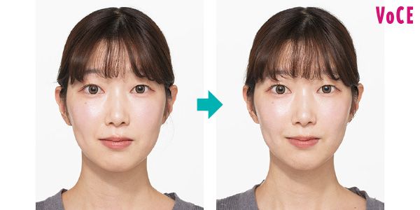 顔の横幅が縮まって、あごのラインも引き上がり、シャープになった。