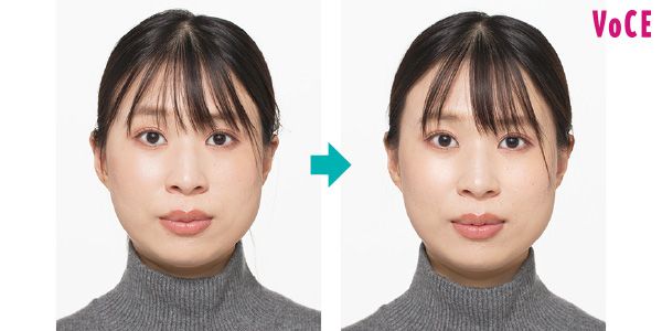 輪郭のもたつきが軽減し、頰の高い位置がキュッと引き上がった。