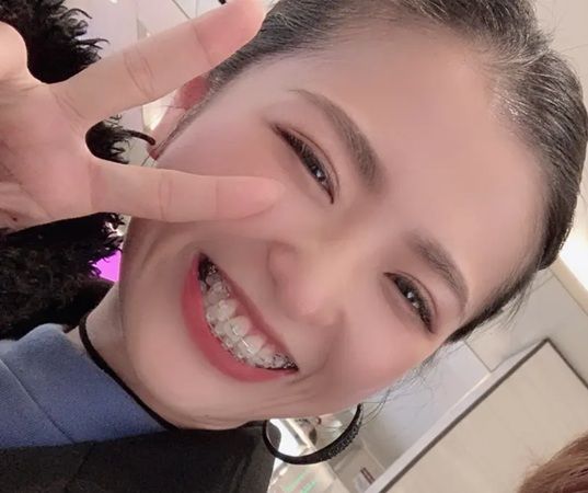 「第21回 ブレーススマイルコンテスト」の受賞作品が決定！矯正歯科治療中の人が対象