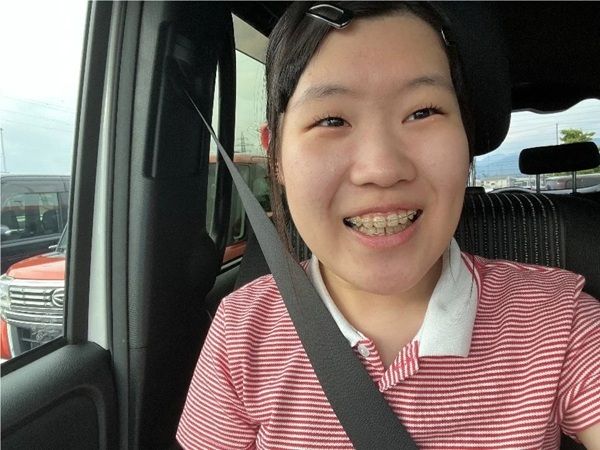 「第21回 ブレーススマイルコンテスト」の受賞作品が決定！矯正歯科治療中の人が対象