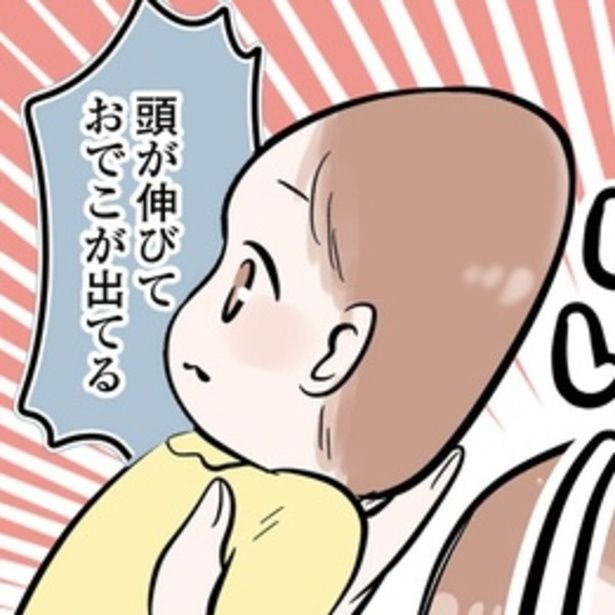 仰向けでよく寝るポン子は次第に頭が伸び、後頭部が超絶壁になってしまった！