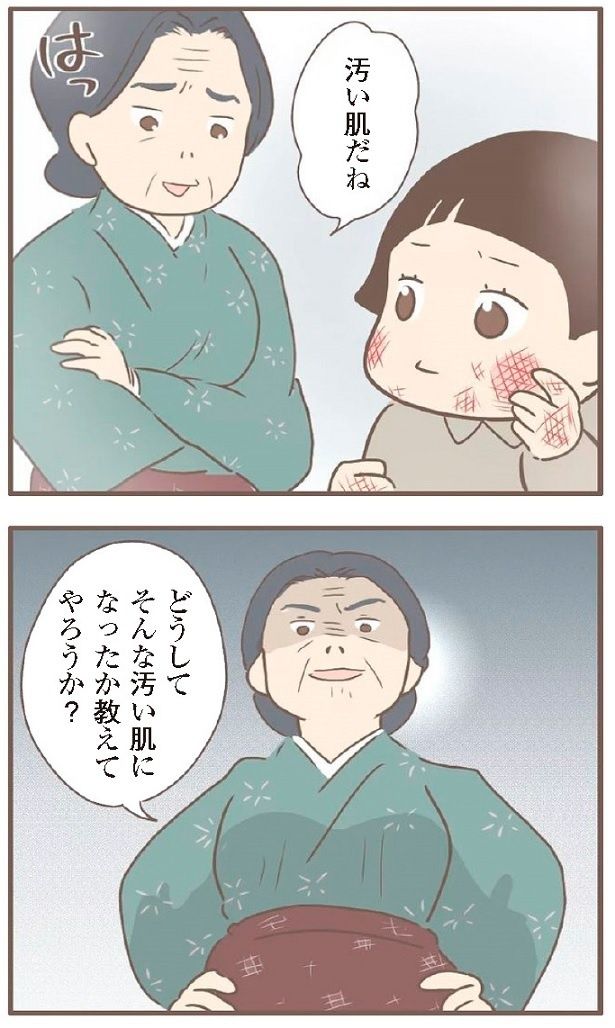 あかぎれだらけの肌を見た養母は意地悪なことを言い…