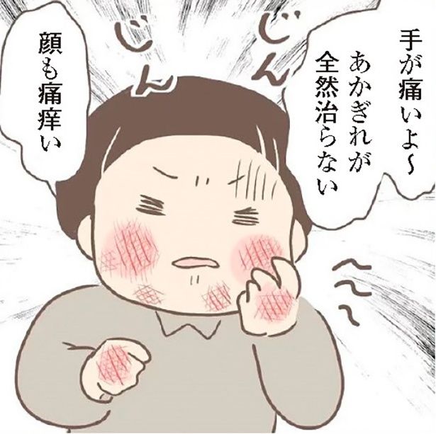 毎日の手洗いでの洗濯に、冬場は手があかぎれだらけで…
