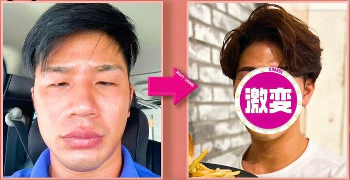 【写真・画像】整形費用300万円で“岩田剛典”になったイケメン、「文春」からのを告白「1番怖いやつじゃん」共演者驚き 1枚目