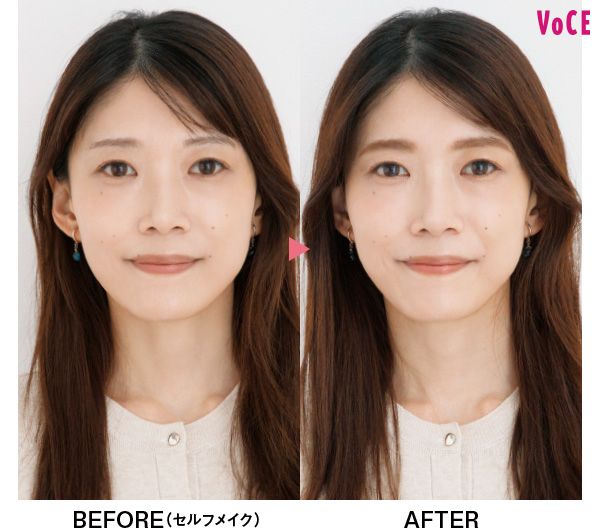 VOCEアンバサダー hachiさん BEFORE AFTER