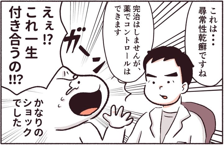 漫画「乾癬になりました」のカット（清野705さん提供）