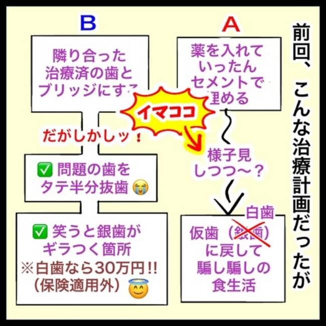 銀歯の下の悲劇／へそ