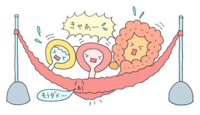 ゆるんだ骨盤底筋のイラスト