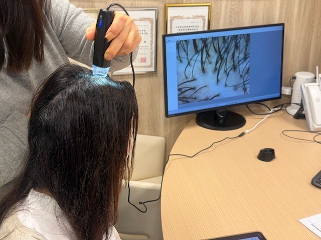 クレアージュ東京のメノケアプラン発毛治療