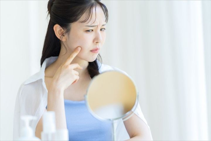 ニキビは放置しちゃいけない？