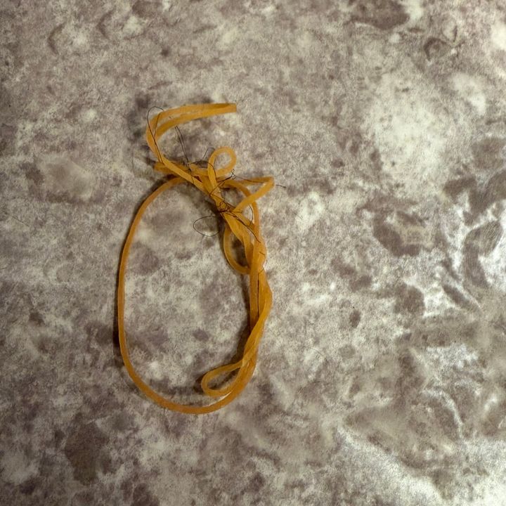 輪ゴムにゴミがついているところ