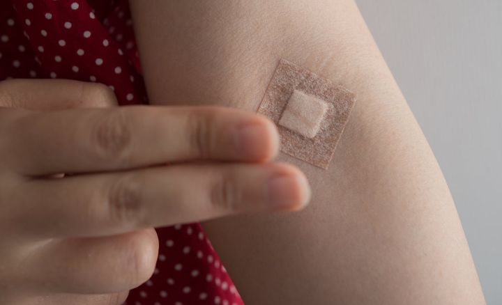 採血のテープはいつまで押さえる？（画像はイメージ）