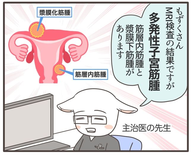 アラフィフが子宮全摘／宮島もっちー