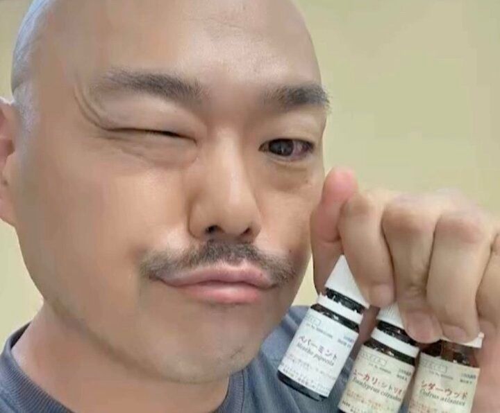 【写真・画像】「ドブ川」「腐った梅干し」クロちゃんとのキスに美女たちが本音 1枚目