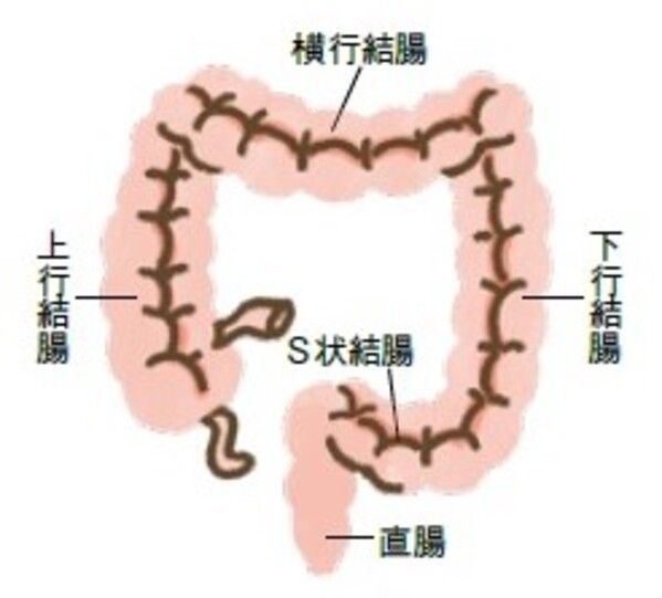 大腸がん 胃がん 検査