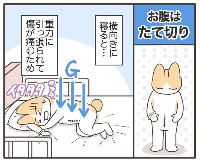 アラフィフが子宮全摘／宮島もっちー