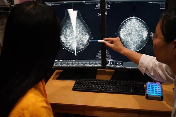 マンモグラフィー検査結果の診断