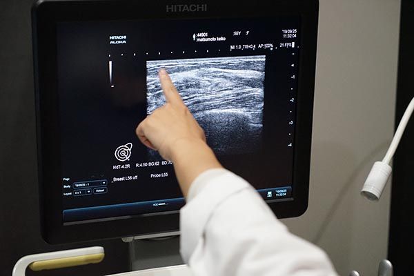 乳房エコー写真を用いた診断