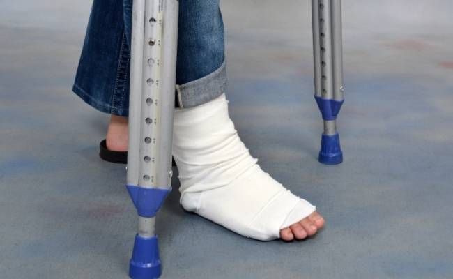 右足首を骨折したイメージ