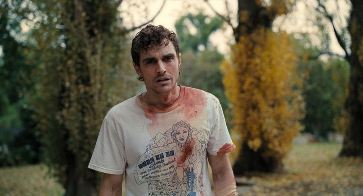 映画『トゥギャザー』血だらけのティム （C）2025 Project Foxtrot, LLC width=