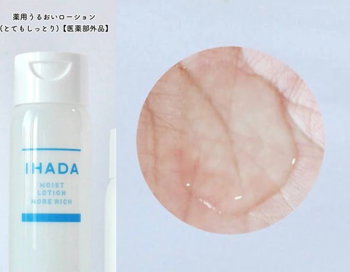 イハダ 薬用うるおいローション（とてもしっとり）