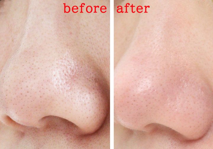 ダイソーの洗顔ブラシのレビュー