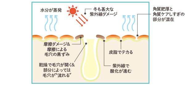 水分が蒸発／冬も甚大な紫外線ダメージ／角質肥厚と角質ケアしすぎの部分が混在／摩擦ダメージ＆摩擦による毛穴の黒ずみ／乾燥で毛穴が開く＆部分によっては毛穴が“流れる”／皮脂でテカる／紫外線で酸化が進む