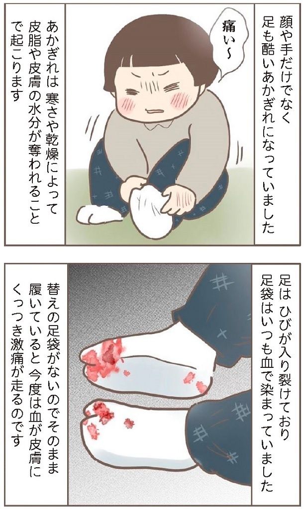 ほとんどの家事をさせられて、冬は特に手足があかぎれだらけに