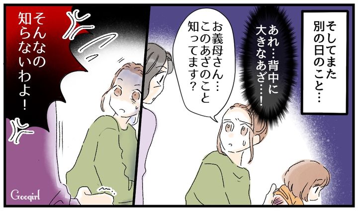 「そんなの知らないわよ！」しらばっくれる義母…娘の体に刻まれたあざの真相を知って絶縁した話