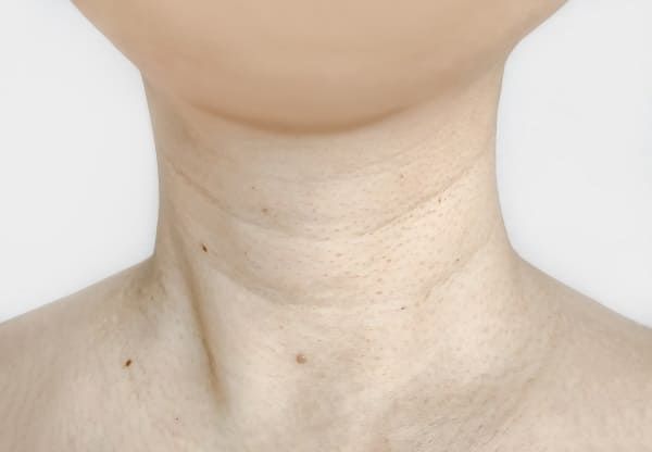 何気ないしぐさや習慣が首のシワ・たるみの原因に！