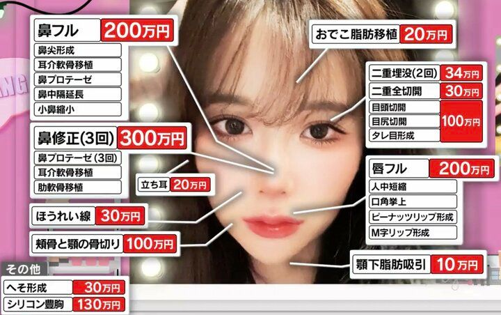 【写真・画像】「1300万円で韓国女優顔に」整形美女が明かす執念の修正遍歴「1回目でアバター顔になって」「耳の軟骨が品切れ」 1枚目