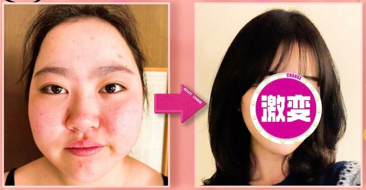 【写真・画像】“卒業後3ヶ月で30キロ増”元アイドルが75キロ→40キロの減量に成功「可愛い！」ビフォーアフターに絶賛の声 1枚目