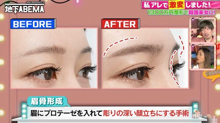 【写真・画像】整形総額1300万円の美女「中華美人に憧れてて」今後やりたい整形を明かす 2枚目