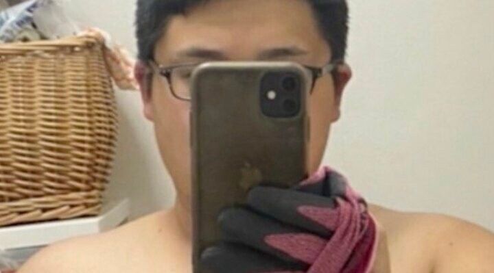 【写真・画像】「140キロ→半年で70キロ減」18歳で糖尿病になった男性、ダイエットのきっかけを告白「20歳の時に告白したら…」 1枚目