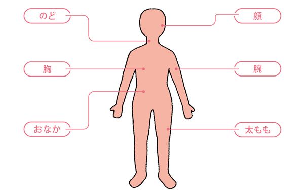 帯状疱疹は上半身に多くできます