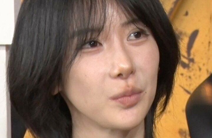 【写真・画像】整形総額1300万円の美女、骨切りダウンタイムの苦しむ明かす「毎朝息ができなくて起きる」 1枚目