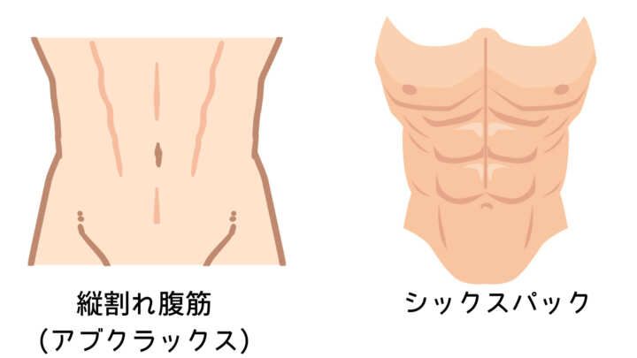 シックスパックと縦割れ腹筋